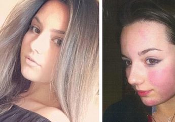 Kisah Pilu Emily, Bunuh Diri Karena Tak Tahan Punya Pacar Idap Kelainan Seksual Sadomasokhis