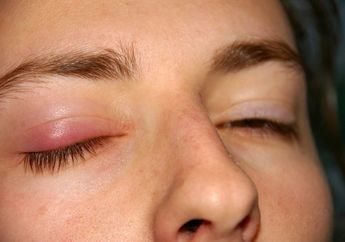 Jangan Lupa Bersihkan Mata, Bisa Bahaya!