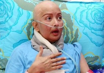 Sungguh Tragis, Yana Zein Meninggal Dunia karena Sel Kanker Sudah Menjalar di Keempat Organ Tubuh Ini