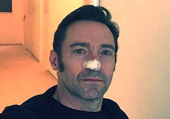 Wow! Hugh Jackman Masih Fit Walau Sedang Jalani Perawatan Kanker Kulit Stadium Lima