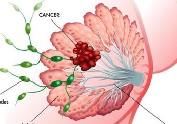 Jika Takut Terkena Kanker Payudara, Makanan Ini akan Membuat Kamu Suka