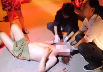 Setelah Berhubungan Intim dengan Ladyboy, Pria Ini Jatuh dari Balkon dalam Keadaan Telanjang