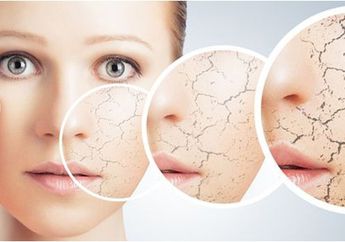 Saat Puasa Kulitmu Kering? Begini Cara Atasinya