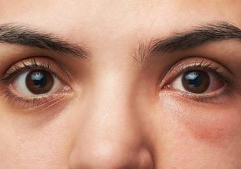 Agar Mata Tetap Sehat, Simak 4 Cara Melindunginya