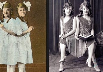 Ketika Si Kembar Siam Sudah Beranjak Dewasa, Saat Bercinta, Ini yang Harus Mereka Lakukan...