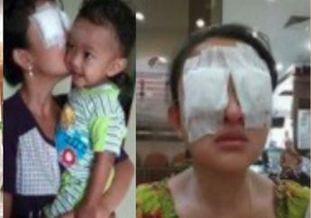 Dunia Wanita Cantik Ini Tiba-Tiba Jadi Gelap Gulita, Ternyata Hal Sepele Ini yang Dilakukan Sebelumnya