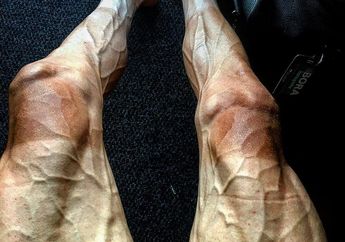 Ngeri, Begini Kondisi Kaki Pebalap Sepeda Profesional Setelah Mengayuh Hampir 3000 KM