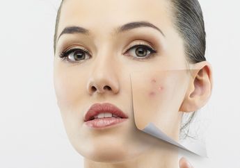 Ternyata Smartphone Bisa Bikin Jadi Jerawatan Lho! Lakukan 4 Cara Ini Untuk Mencegahnya