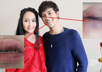 Mulutmu Harimaumu, Satu Kata Inilah Yang Memicu Dicky SMASH Dihajar Sampai Babak Belur