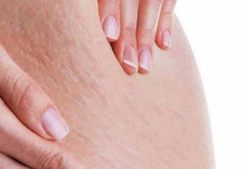 Ampas Kopi Ampuh Hilangkan Selulit, Mitos Atau Fakta nih ?