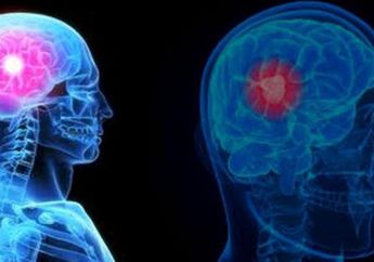 Ini 16 Gejala dan Ciri Kanker Otak yang Harus Diketahui, No 2 Wajib Diwaspadai!