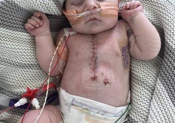 Penuh Haru, Kisah Seorang Ibu yang Tidak Pernah Menyerah Meski Anaknya Lahir dengan Setengah Jantung