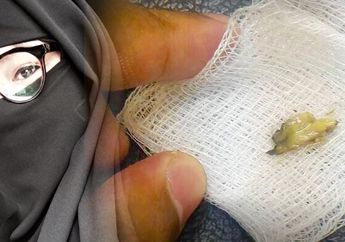 4 Minggu Rasakan Perih di Telinga, Wanita ini Kaget Begitu Dokter THT Beritahu Penyebabnya