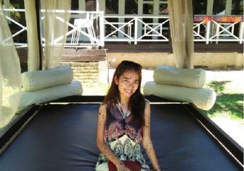 Tidak Usah Merasa Minder Dengan Kekurangan, Wanita Ini Buktikan Kekurangan Menjadi Kekuatan