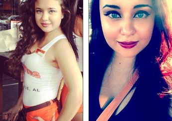 Mahasiswi Cantik ini Sebulan Hilang di Hutan, Lihat Perubahan Wajahnya Ketika Pertama Kali Ditemukan!