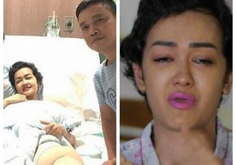 Memprihatinkan, Begini Bentuk Kaki Jupe Hingga Membuatnya Sulit Berjalan