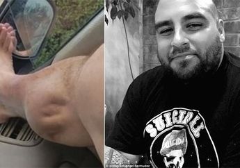 Ngilu, Usai Fitness, Kaki Pria Ini Berdenyut Seperti Jantung, Lihat Videonya