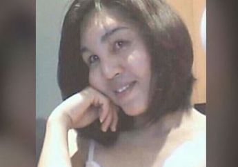  Bahaya! Gara-gara Suntikan Murah, Bukannya Tirus Pipi Perempuan Ini Malah Jadi Begini