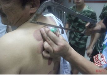  Niatnya Buang Racun Dalam Tubuh, Malah Begini Hasilnya