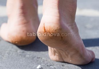 Tak Terduga, 4 Bahan Alami Ini Ampuh Atasi Kulit Kaki Pecah-pecah dan Bersisik