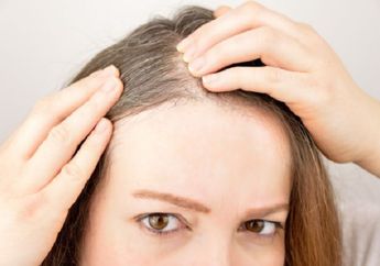 Masih Muda Kok Ubanan? Dih, Ternyata Ini Penyebab Rambut Beruban, Nomor 5 kok Bisa sih?