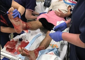 Kaki Lelaki Ini Tiba-tiba Berdarah Saat Berada di Pantai, Ternyata Karena Dimakan Hewan Kecil Ini