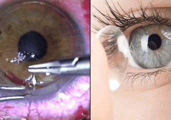 Hanya Karena Hal Sepele Ini, Mata Seorang Wanita Alami Hal Mengerikan