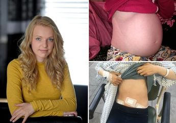 Bukan Hamil! Perut Gadis Ini Terus Membesar, Ternyata Isinya Bikin Dokter Kaget