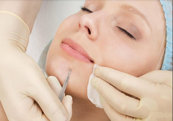 Makeup Menghasilkan Komedo di Hidung Kamu, Begini Penjelasan dari Pakar Kulit