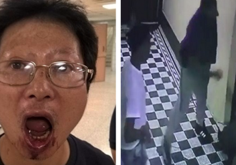 Dilempar Botol Sampai Dirampok, Pria Pengantar Makanan Ini Jadi Target Remaja New York, Kenapa Ya?