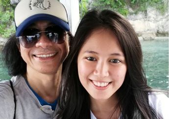 Gitaris SLANK Abdee Negara Gagal Ginjal, Bimbim Jelaskan Kondisi Kesehatan