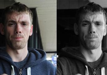 Pria Ini Ingin Memotong Tangannya Sendiri, Ternyata Ini yang Terjadi