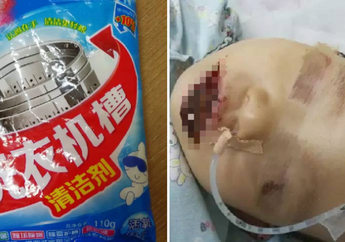 Makan Sabun Cuci, Seorang Anak Alami Luka Serius di Bagian Ini