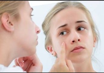 Ini 3 Masalah Kulit yang Sering Dialami Para Wanita, Ada Cara Mengatasinya Juga!