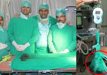 Tak Bisa Berhenti Makan Rambut Sendiri, Saat Dibedah Perutnya Sudah Terisi Gumpalan Hitam Besar, Simak Fotonya