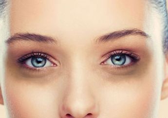 Siapa Sangka Lingkaran Hitam di Bawah Mata Bisa Bawa Kamu Ke Masalah Kondisi Kesehatan yang Serius