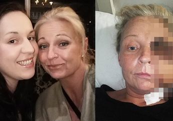 Muka Wanita Ini Seperti Mutan, Padahal Cuma Karena Kaki Keram, Sang Anak Kaget Temukan Darah Sudah Menggenang di Mana-Mana