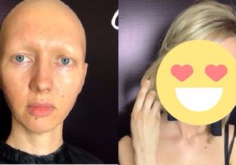 Luar Biasa, Makeup Artist Ini Bikin Pengidap Kanker Jadi Percaya Diri, Lihat Perubahan Drastis Penampilannya