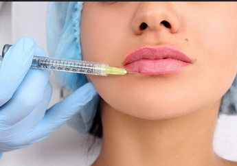 Sama-sama Memberikan Efek Mancung pada Hidung, Ini Perbedaan Tanam Benang dan Suntik Filler Untuk Kecantikan