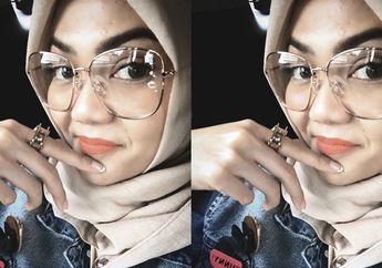 Habis Nyindir Netizen, Rina Nose Kena Bintitan!