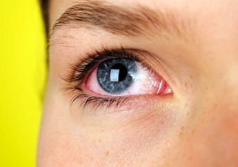 Apa sih Sindrom Mata Kering Itu? Kenali Sebabnya dan Cegah Sebelum Terjadi