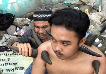 Terkenal Sampai ke Luar Negeri, Ini Teknik Penyembuhan Pakai Tanduk Kerbau