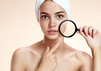 Ini yang Perlu Dilakukan Kalau Punya Kulit Berjerawat, Apa Aja ya?