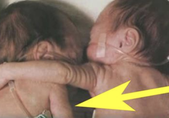 Momen Penuh Emosional, Lihatlah Salah Satu Dari Saudara Kembar Ini Sekarat, Ketika Perawat Meletakan Salah Satu Bayi ini Sebagai Ucapan Selamat Tinggal Hal Ajaib Terjadi