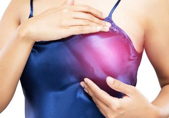 Benjolan di Payudara Belum Tentu Kanker, Ini Penjelasannya