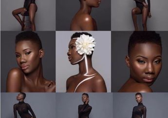 Dibully Karena Warna Kulit, Siapa Sangka Wanita Ini Malah Jadi Begini