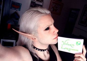  Pria Ini Melakukan Operasi Plastik Lantaran Ingin Mempunyai Bentuk Muka Layaknya Peri