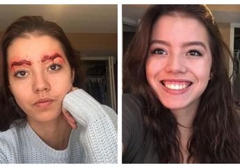 Viral Foto Gadis Cantik dengan Alis Mengerikan dan Terlihat Penuh Luka, Ternyata Ini Penyebabnya!