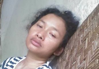 Wajah Melas dan Lesu TKW Asal Madiun, Pulang ke Indonesia Idap Penyakit Ini, Suami Tega Lakukan Hal Keji Bikin Marah Perempuan