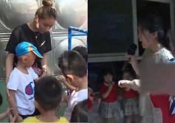 Bocah Ini Ditolak di Banyak TK Karena Kondisi Wajahnya, Akhirnya Ada 1 Sekolah yang Menerima dan Ternyata Justru Itu Sekolah.....